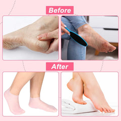 Reusable Moisturizing Silicone Socks